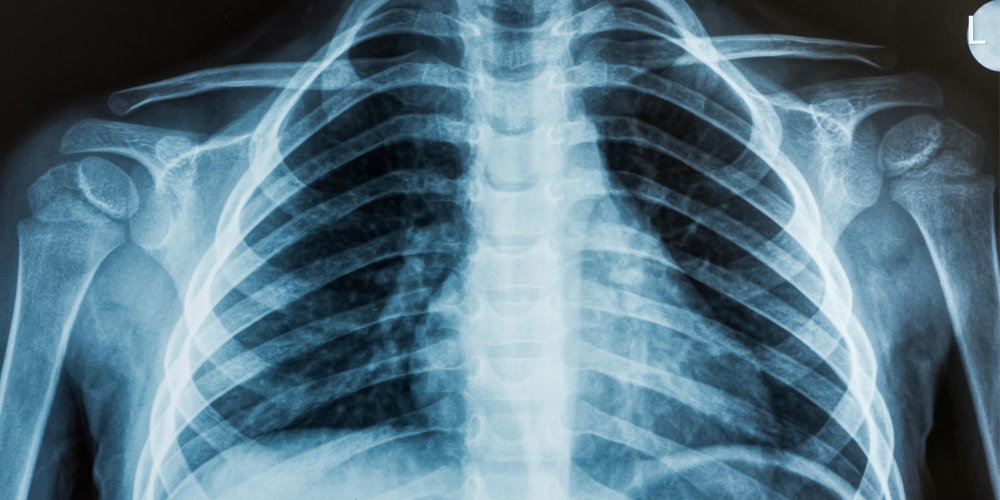 Xray_share